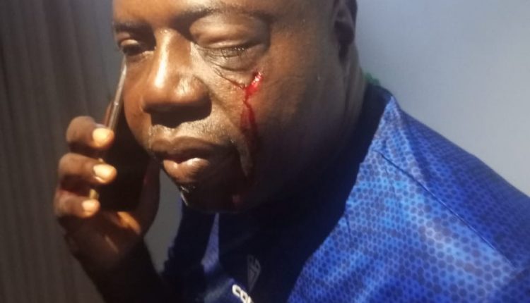 How Hoodlums Invaded Lekan Salami Stadium,Dehumanized,Injured And …[Photos]