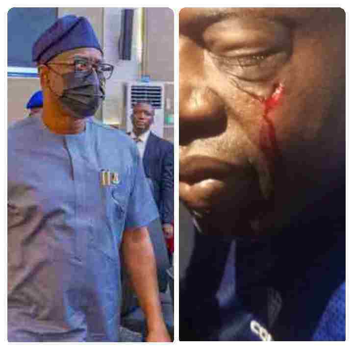 Oyo State Government Condemns Attack on Oyo Sports Council Chairman[Photo]