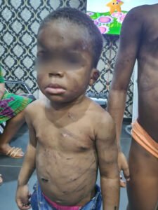 Woman and her partner arrested for allegedly battering her two children aged 5 and 2....see horrific photos of their battered bodies